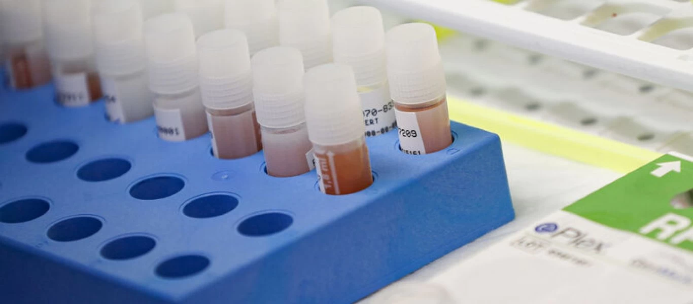 Ελπίδες ότι θα είναι έτοιμο το φάρμακο για τον κορωνοϊό στην Ελλάδα έως τον Ιούλιο